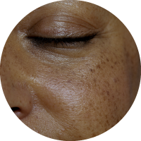 Rejuvenescimento